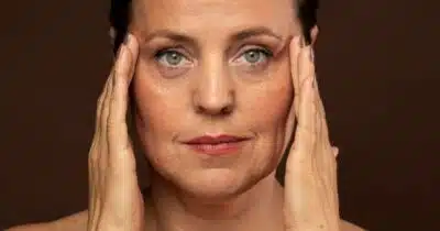 Rosto envelhecido - Foto: Internet